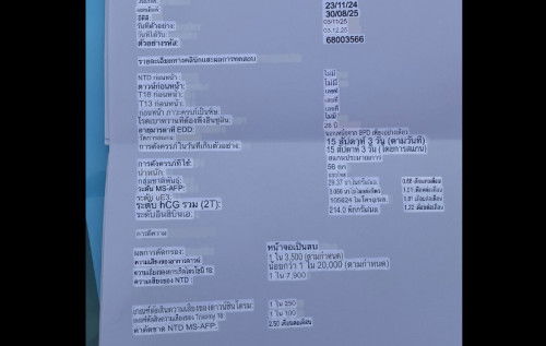 ตรวจคัดกรองดาวน์