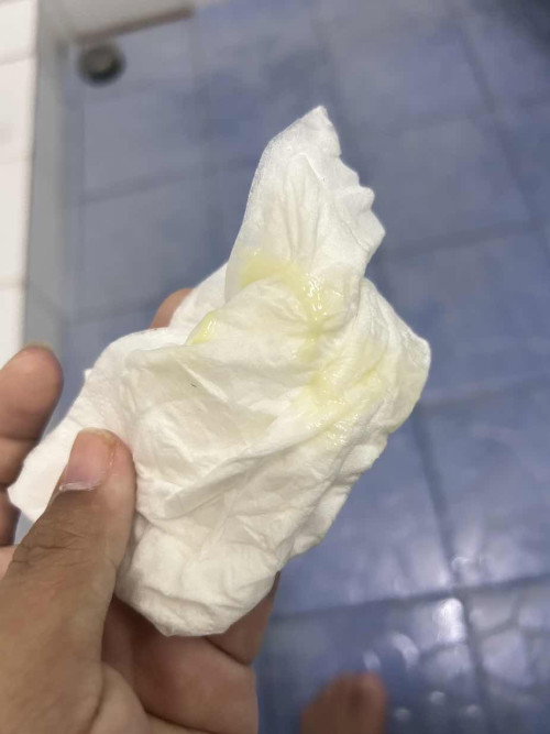 อันนี้มูกหรือตกขาวคะ