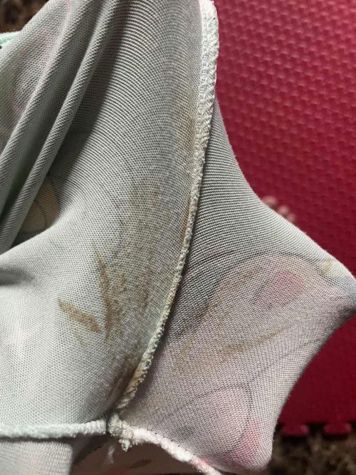 สอบถามค่ะแบบนี้คืออะไีรคะ ต้องไปหาหมอมั้ย ขออภัยในรูปภาพไม่เหมาะสมนะคะ