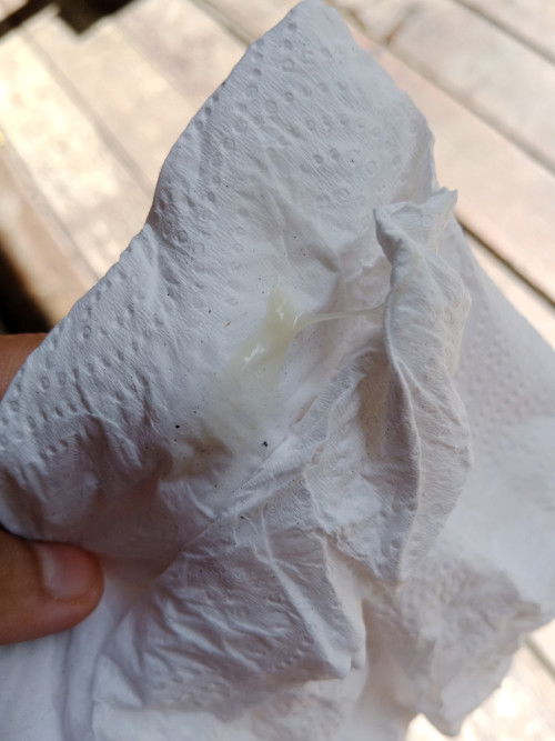 normal ke keputihan macam ini pada kandungan 9week?maaf sebab gambar ini kotor