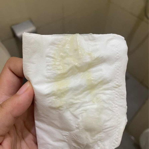 Hamil 17 minggu keluar cairan putih