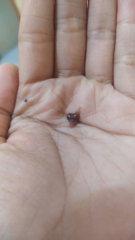 Flek kecoklatan tanda Siaga