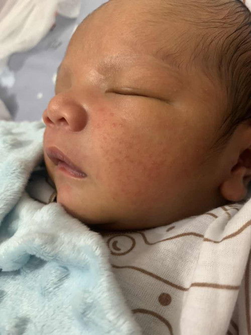 Pipi newborn merah kenapa