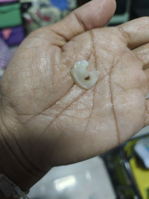 ตั้งครรภ์ได้ 17 สัปดาห์ 5 วันแล้วมีตกขาวพร้อมจุดสีดำแบบนี้อันตรายต่อน้องในท้องไหมคะ