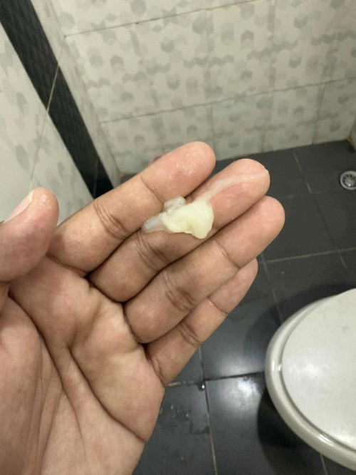 ขอสอบถามค่ะ