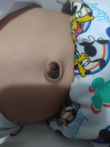 Pusod ni baby