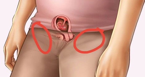 Before check doctor, just nak tanya. Is it normal untul rasa sakit2 area yang dibulatkan..