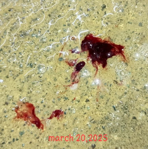 Spotting shared ko lang na fefeel ko ngayun.😭