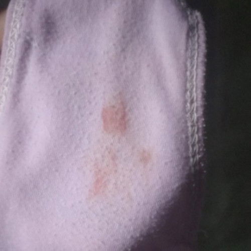 Bun usia kandunganku baru 32mnggu, tpitdi keluar kekgini, itu flek capek atau gmna ya?