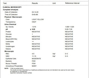 Urinalysis test