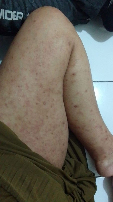 Masih dengan keluhan yang sama 🥹 memasuki TM3 anak ketiga baru ini, dulu gapernah gini