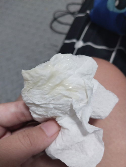 อยากสอบถามแม่ๆค่ะ อันนี้ตกขาวหรือไกล้คลอด