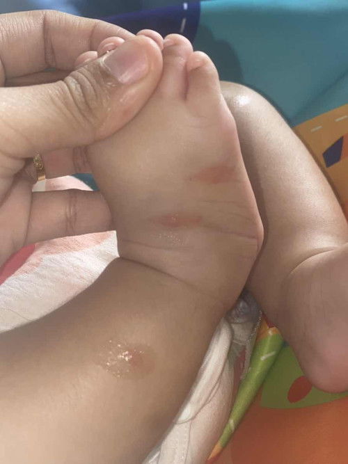 3 bulan dah mula ada bintik merah