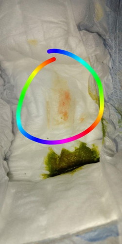 Normal lang po ba ito sa new born baby sa ihi nya bali pang 2 days napo ngayon