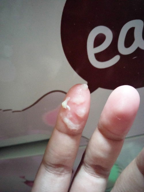 Bantu Jawab Bun hamil ank pertama