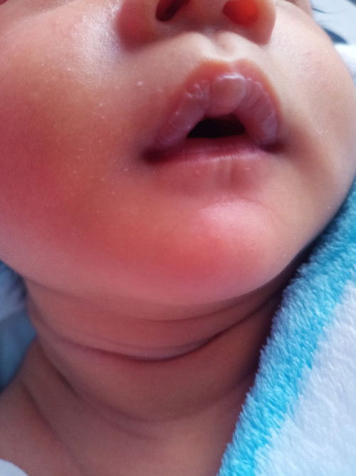 ริมฝีปากลูกเป็นคราบแบบนี้ปกติไหมคะ