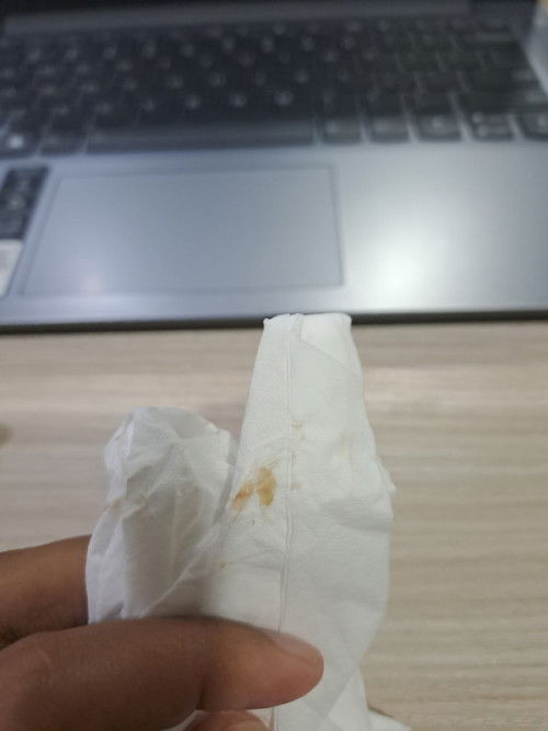 INI FLEK BUKAN YA?