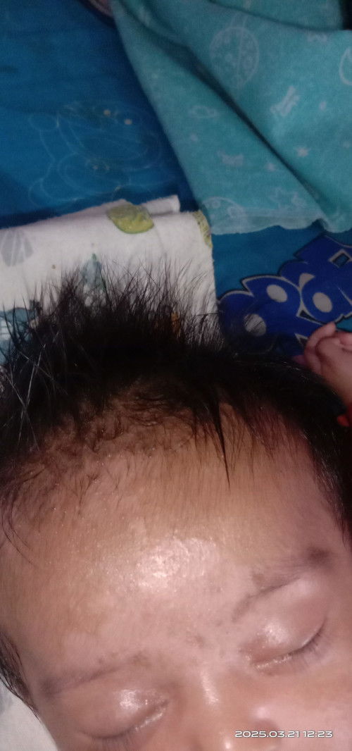 Masalah kulit anak umur 2 bulan