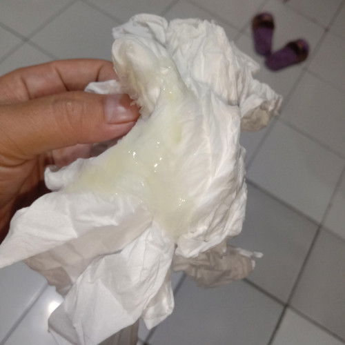 Keluar lendir saat masuk 37w