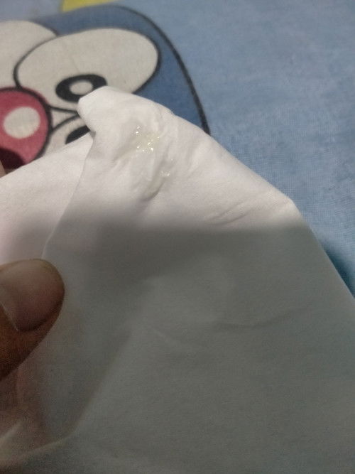 37+4week อย่างนี้ปกติมั้ยคะ