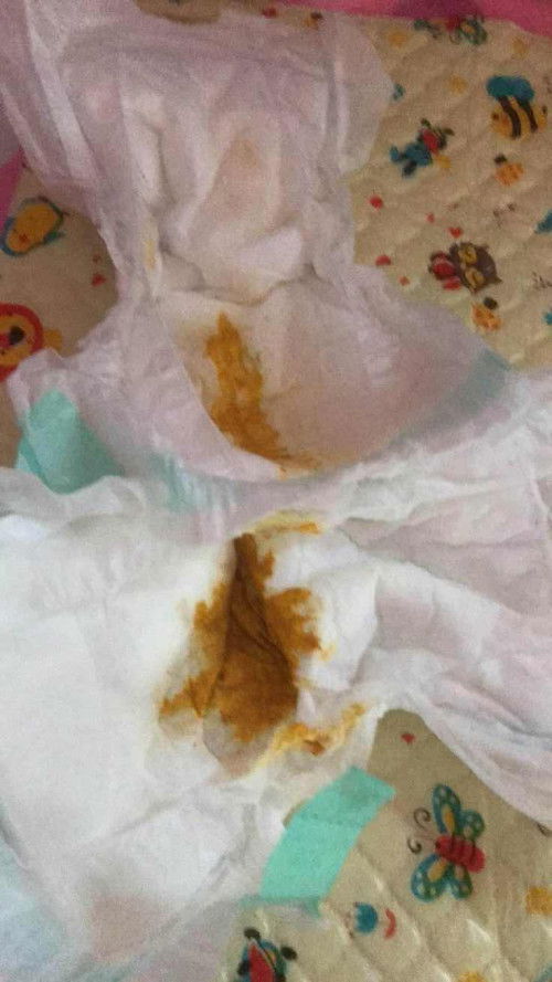 สอบถาม สีอึแบบนี้ปกติมั้ยคะ