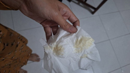 Flek / keputihan