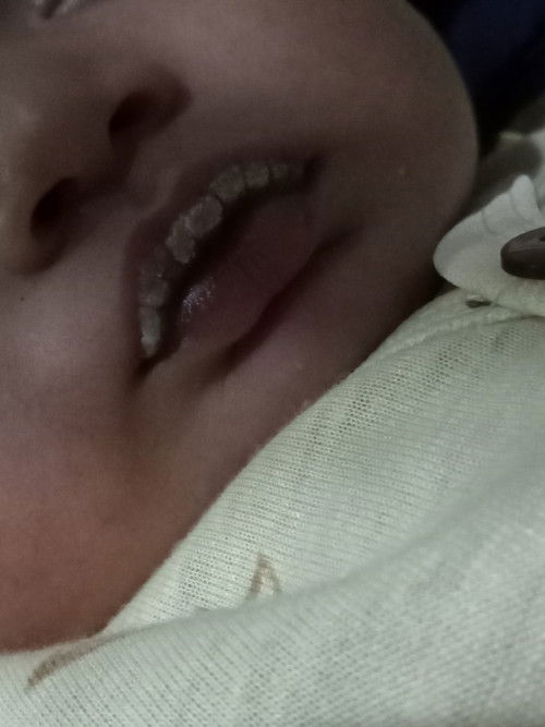 Bibir newborn