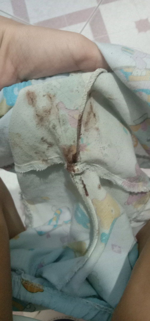 เลือดออกตอน9วีค