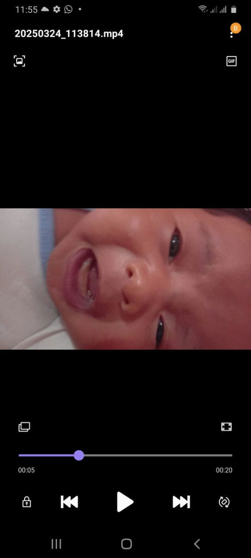 Kenapa ada bintik di gusi