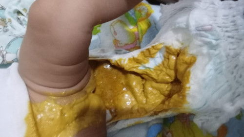 Bab bayi sufor mix asi