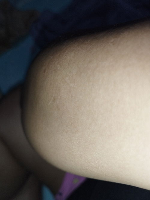 Blessed evening po mga mommy, ask ko lang po kung ano po kaya ito?