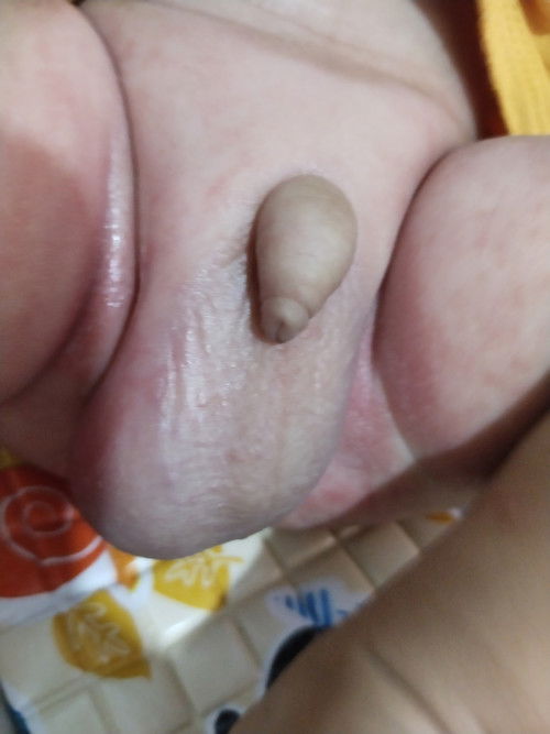 Ruam diselakangkangan