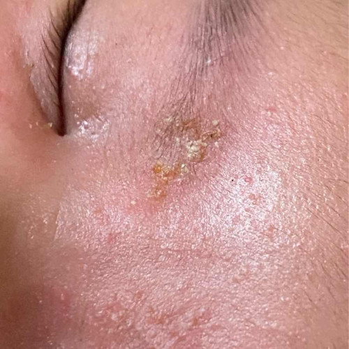 สอบถามแม่ๆหน่อยคะ