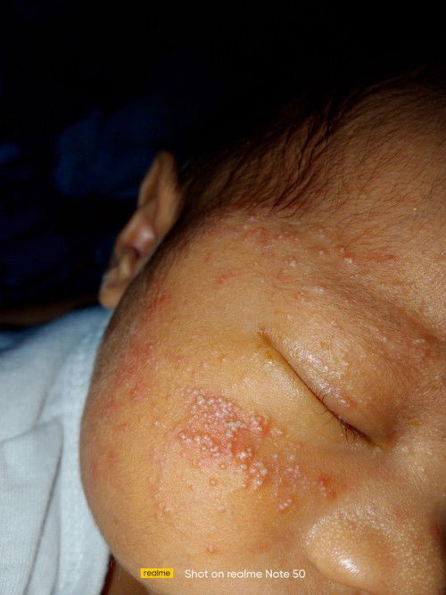 Ano po kaya tong tumubo kay baby pahelp naman po mga mommy ano po kaya pwedeng ipahid sakanya