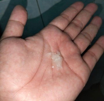 39วีคมีมูกออกมาใกล้คลอดยังคะ