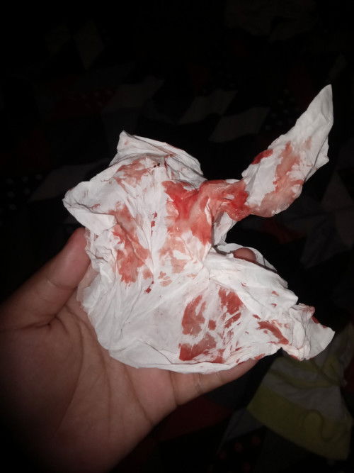 Bun kenapa ya saya keluar darah bercampur lendir apakah keguguran bun