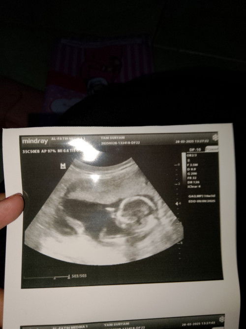 16weeks 3day