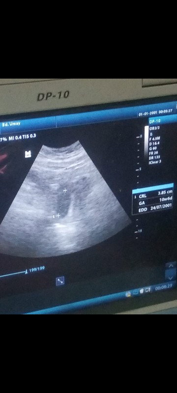 Diagnosa sementara dokter bilang janin saya tidak berkembang