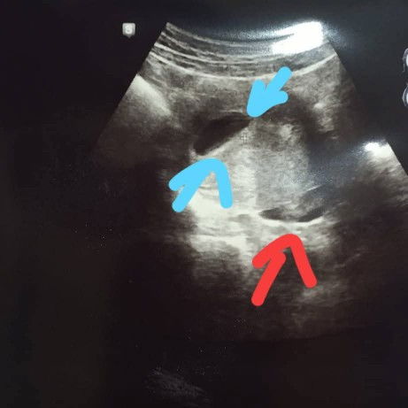 Boleh terangkan siapa yang tahu? 6w2d