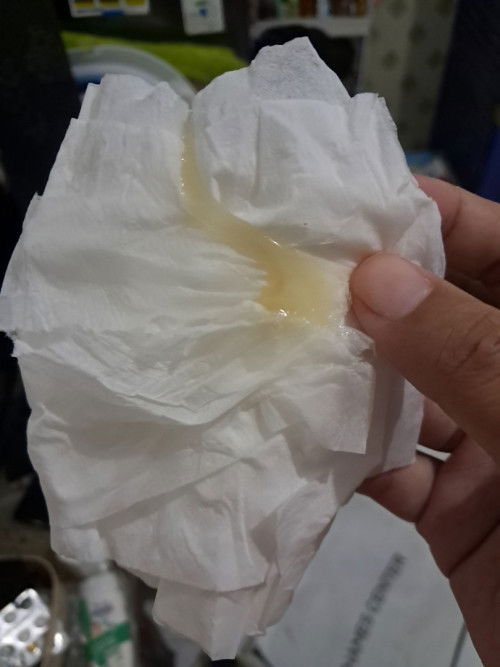 Lendir kuning di 32w