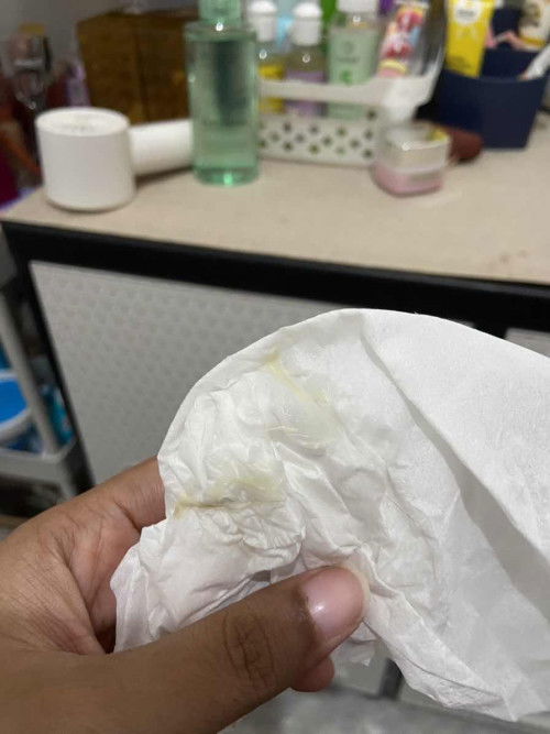 keputihan lendir kuning ‼️