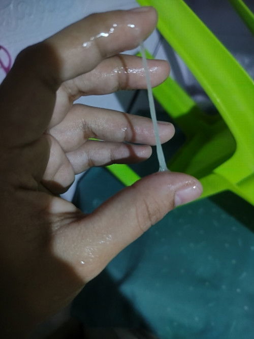 Mucus plug po ba ito or normal white discharge lang?