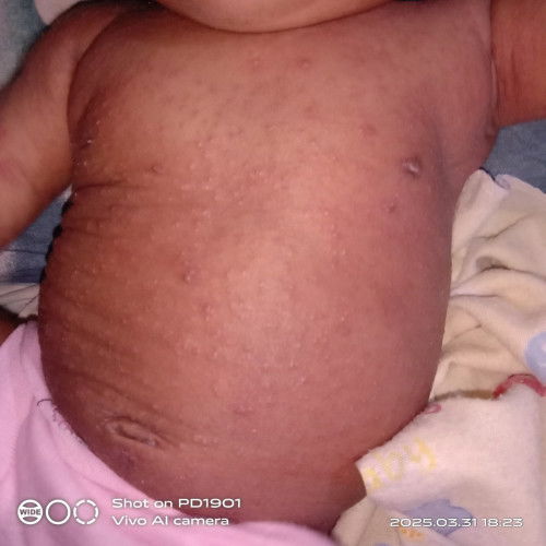 Kasi tau obat nya dong Bun..buat sakit ky gini...udh k dokter TPI blm smbh jg.