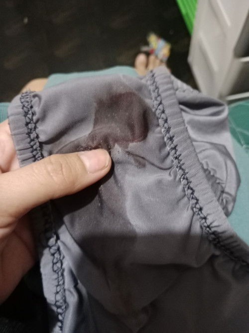 Ano po gagawin kapag may gantong dugo first time po