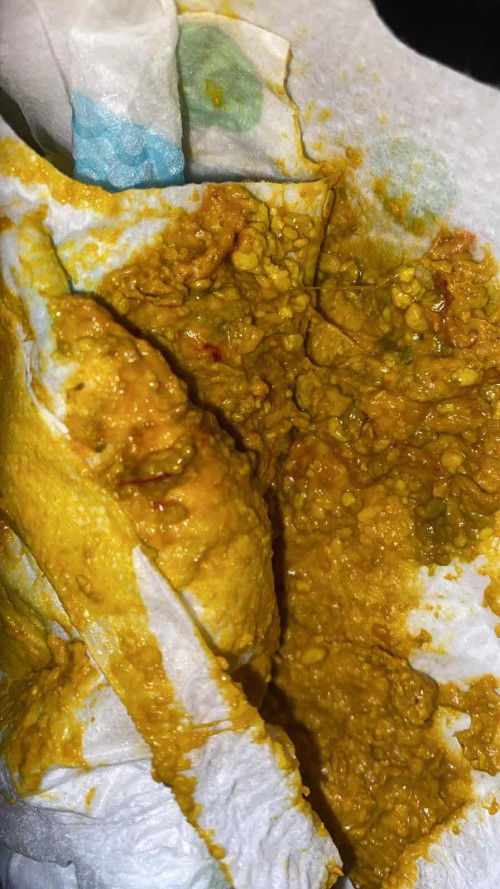 แม่ๆบ้านไหนน้องถ่ายแบบบนี้บ้างคะ