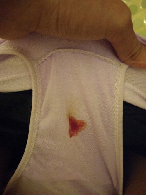 hamil 5minggu Kluar flek