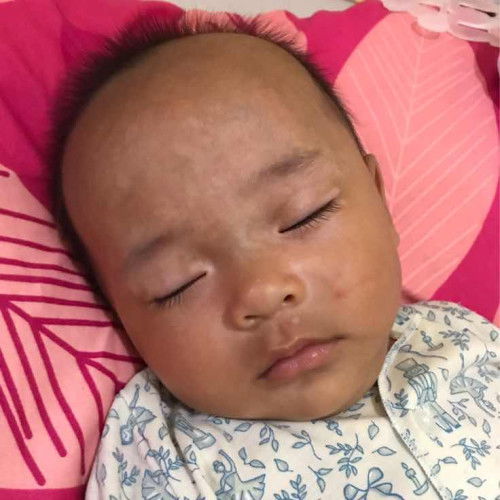 Bintik putih di wajah , dada dan punggung