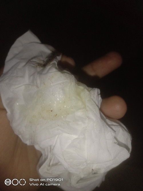 Bun saya hamil 35w4d ini keluar lendir seperti ini dan perut kencang perut mulas  apakah ini normal
