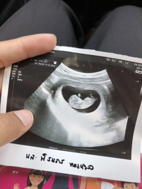 แม่ๆรู้เพศน้องตอนกี่wกันค่ะ