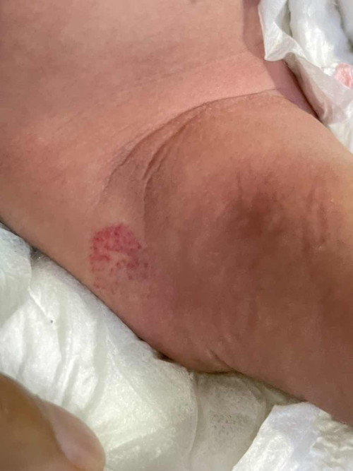 ไม่รู้ทำไมมีรอยแบบนี้ขึ้น